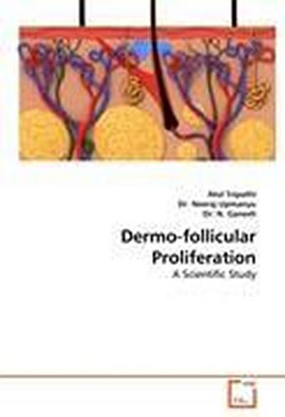 Dermo-follicular Proliferation