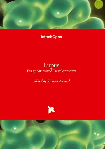 Lupus - Diagnostics and Developments