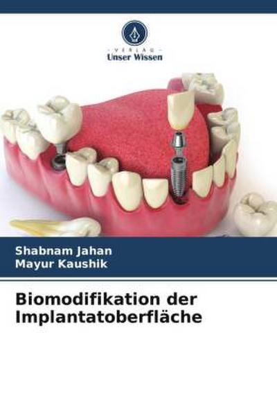 Biomodifikation der Implantatoberfläche