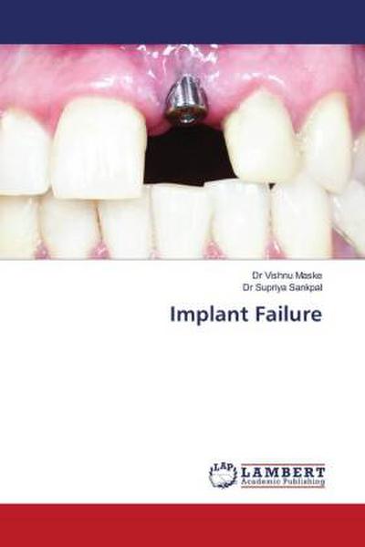 Implant Failure