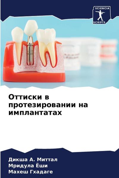 Ottiski w protezirowanii na implantatah