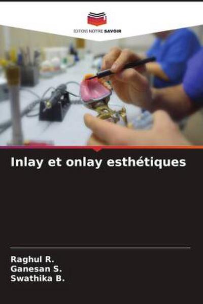 Inlay et onlay esthétiques