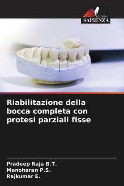 Riabilitazione della bocca completa con protesi parziali fisse