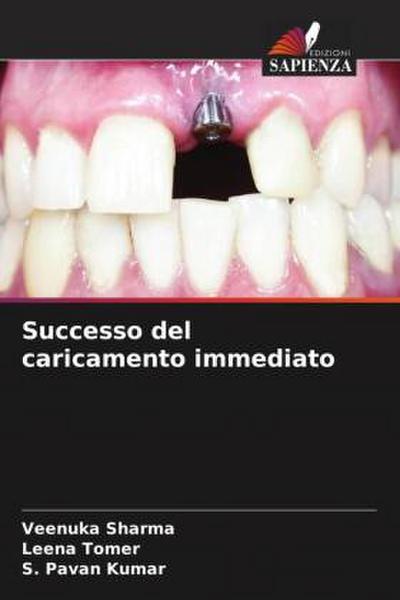 Successo del caricamento immediato