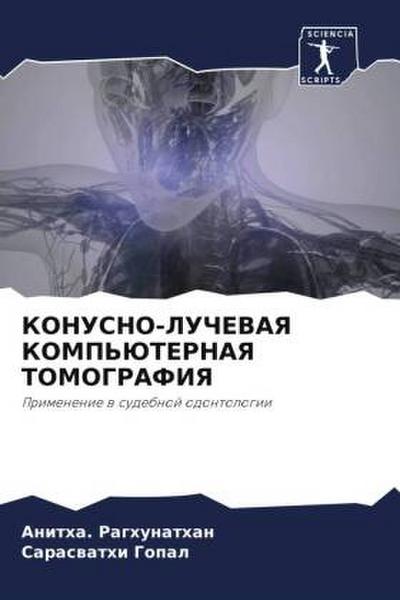 KONUSNO-LUChEVAYa KOMP’JuTERNAYa TOMOGRAFIYa