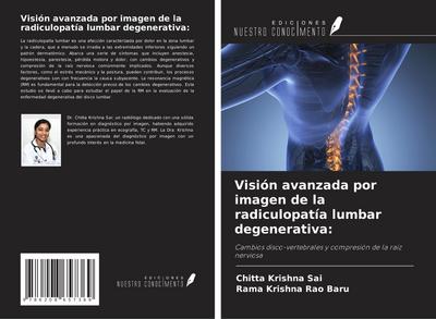 Visión avanzada por imagen de la radiculopatía lumbar degenerativa: