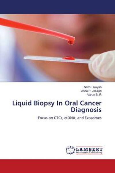 Liquid Biopsy In Oral Cancer Diagnosis
