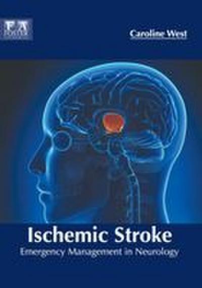 Ischemic Stroke