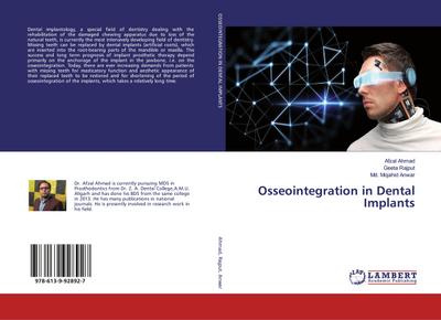 Osseointegration in Dental Implants