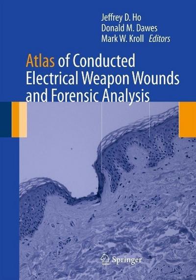 Atlas of Conducted Electrical Weapon Wounds and Forensic Analysis