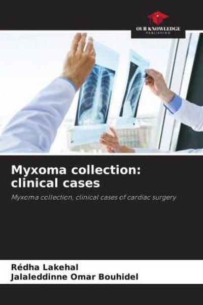 Myxoma collection: clinical cases