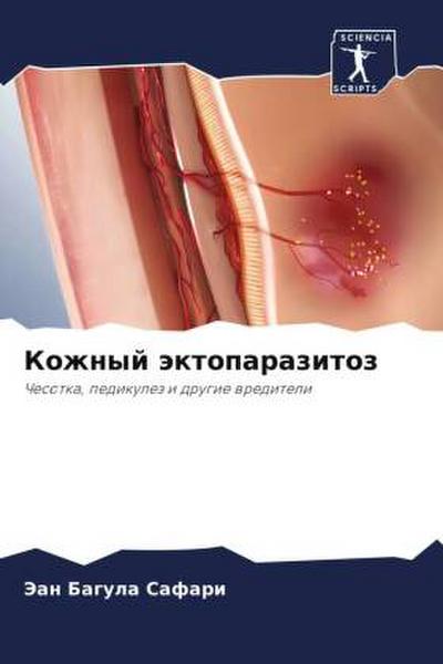 Kozhnyj äktoparazitoz