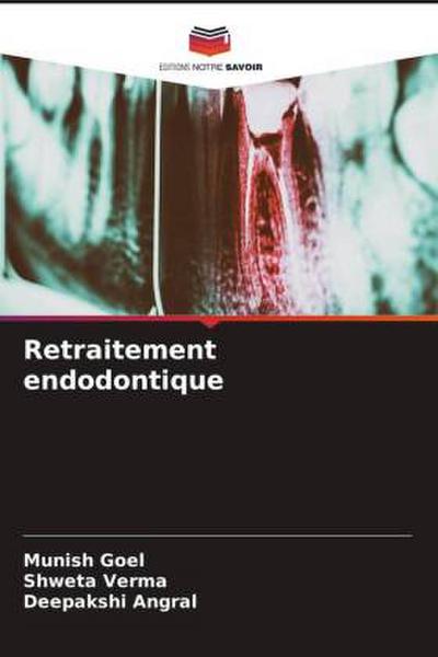 Retraitement endodontique