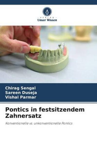 Pontics in festsitzendem Zahnersatz