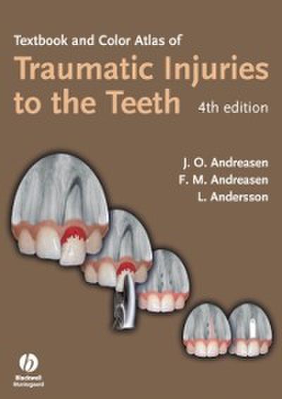 Textbook and Color Atlas of Traumatic Injuries to the Teeth