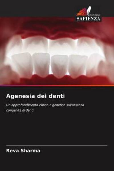 Agenesia dei denti