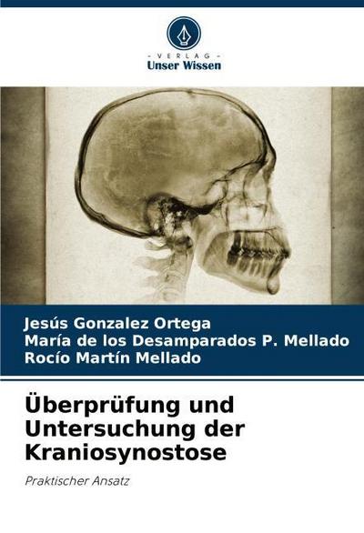 Überprüfung und Untersuchung der Kraniosynostose