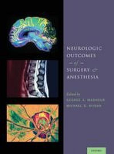 Neurologic Outcomes of Surgery and Anesthesia