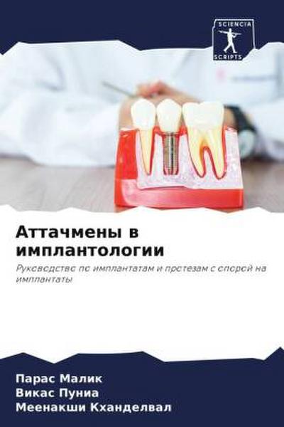 Attachmeny w implantologii