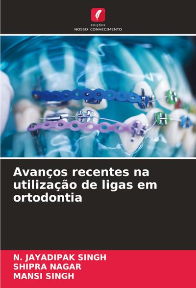 Avanços recentes na utilização de ligas em ortodontia