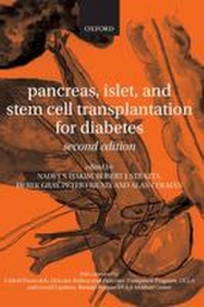 Pancreas, Islet and Stem Cell Transplantation for Diabetes