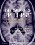 Causes of Epilepsy