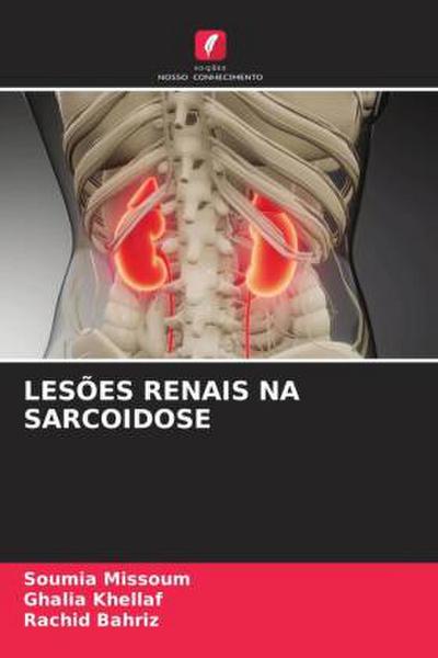 LESÕES RENAIS NA SARCOIDOSE