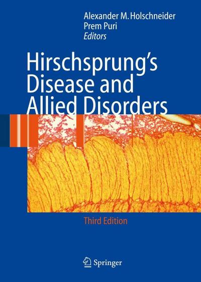 Hirschsprung’s Disease and Allied Disorders