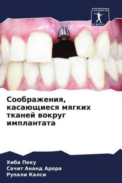 Soobrazheniq, kasaüschiesq mqgkih tkanej wokrug implantata