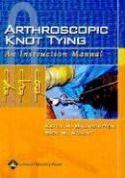 Arthroscopic Knot Tying