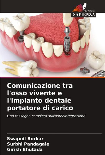 Comunicazione tra l’osso vivente e l’impianto dentale portatore di carico