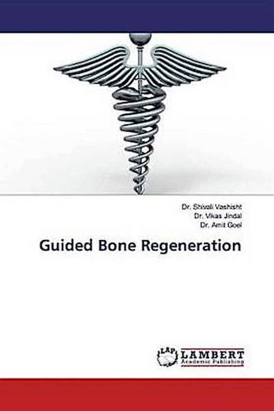 Guided Bone Regeneration