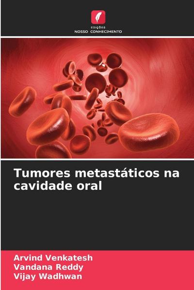 Tumores metastáticos na cavidade oral