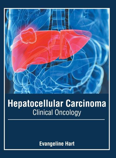 Hepatocellular Carcinoma: Clinical Oncology
