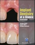 Implant Dentistry at a Glance