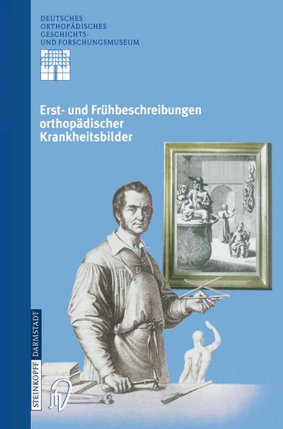 Erst- und Frühbeschreibungen orthopädischer Krankheitsbilder