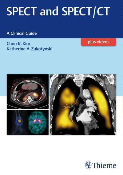 SPECT and SPECT/CT