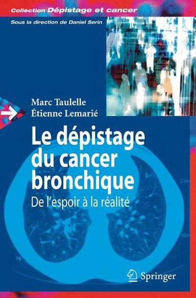 Le dépistage du cancer bronchique