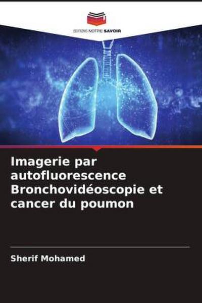 Imagerie par autofluorescence Bronchovidéoscopie et cancer du poumon