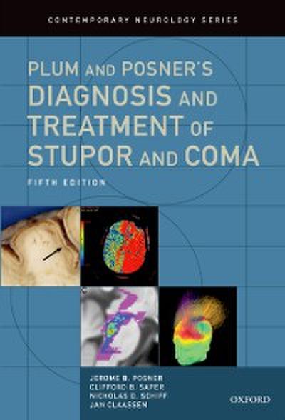 Plum and Posner’s Diagnosis and Treatment of Stupor and Coma