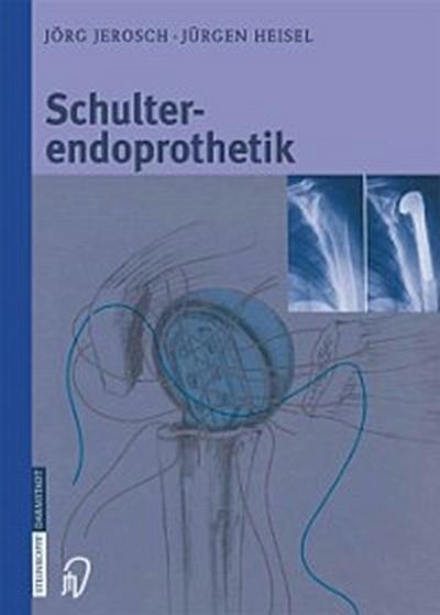 Schulterendoprothetik