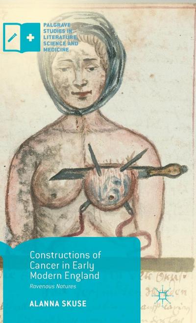 Constructions of Cancer in Early Modern England