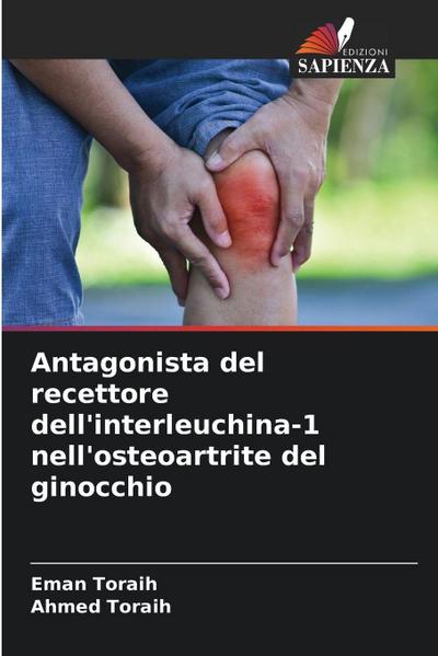 Antagonista del recettore dell’interleuchina-1 nell’osteoartrite del ginocchio