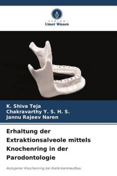 Erhaltung der Extraktionsalveole mittels Knochenring in der Parodontologie