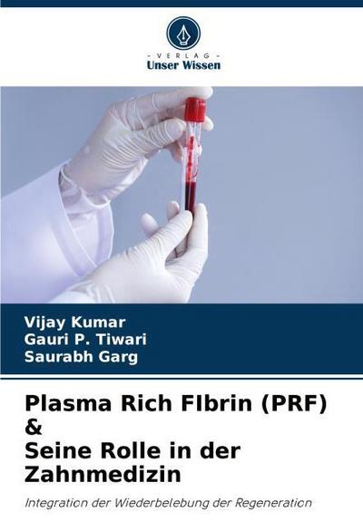 Plasma Rich FIbrin (PRF) & Seine Rolle in der Zahnmedizin