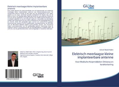 Elektrisch meerlaagse kleine implanteerbare antenne
