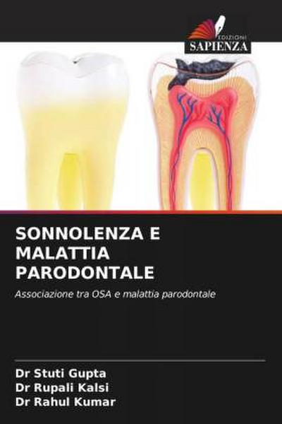 SONNOLENZA E MALATTIA PARODONTALE