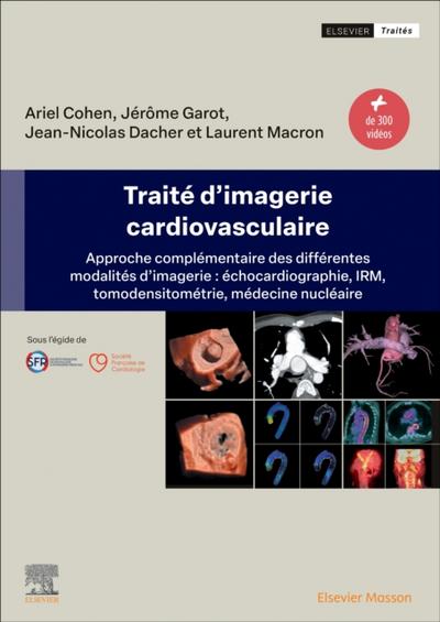 Traite d’imagerie cardiovasculaire