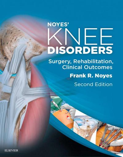 Noyes’ Knee Disorders: Surgery, Rehabilitation, Clinical Outcomes E-Book