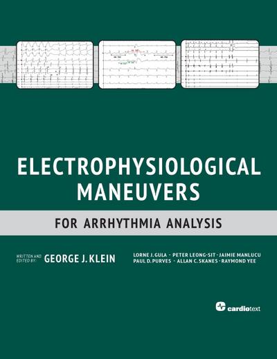 Electrophysiological Maneuvers for Arrhythmia Analysis